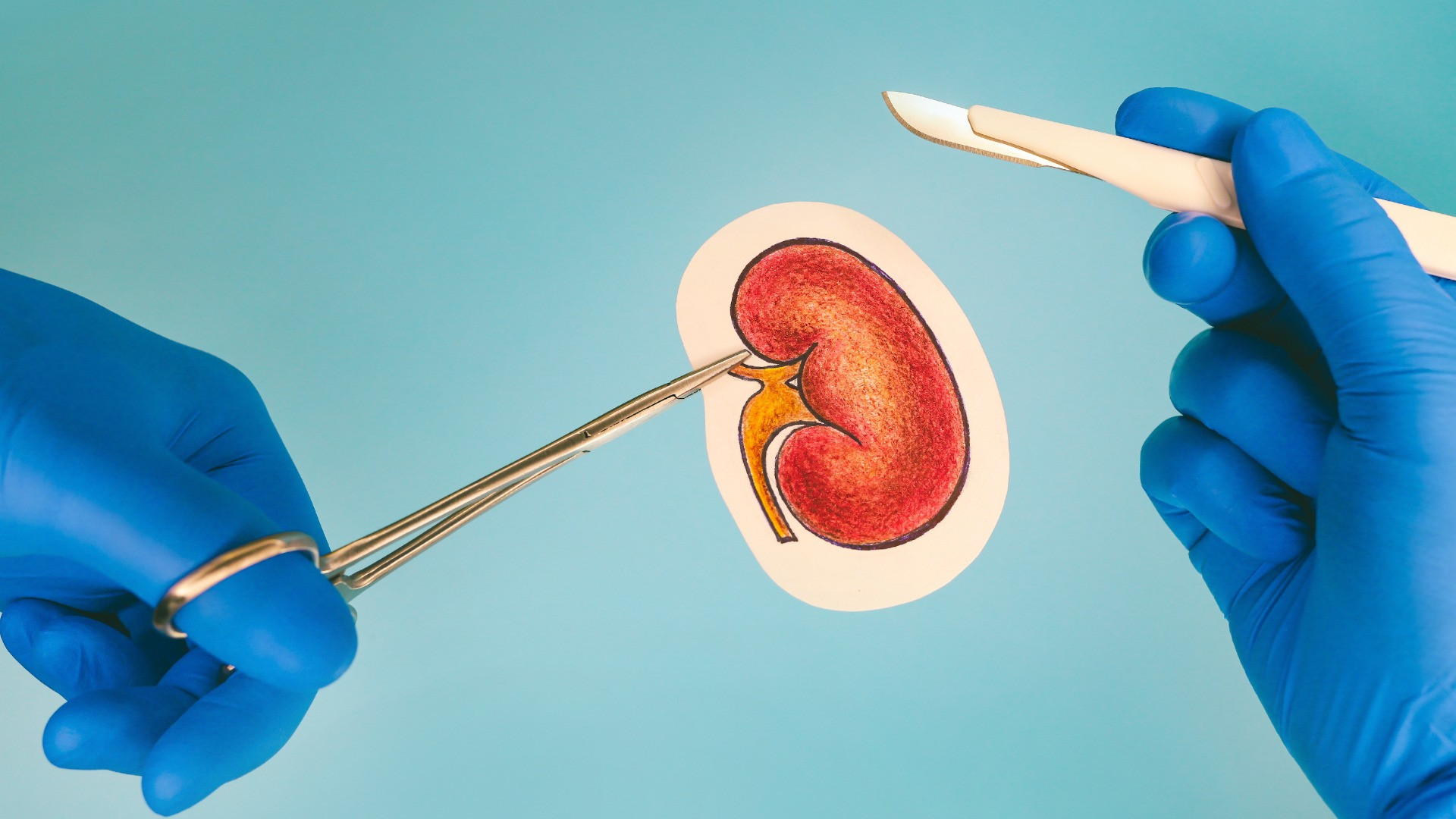 Così il trapianto di organi di maiali nell'uomo è realtà