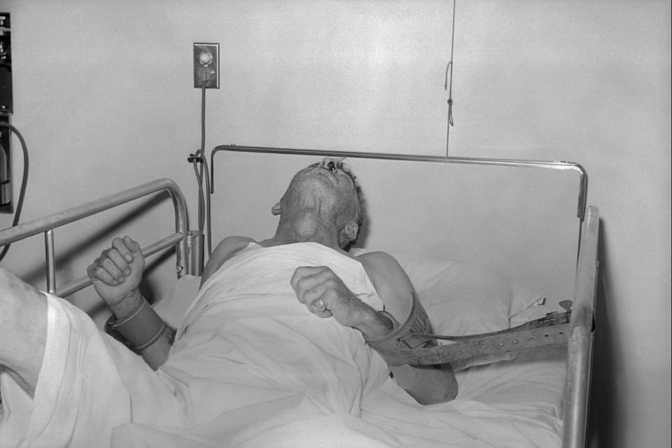 Ventinove persone colpite dall'idrofobia in Svizzera