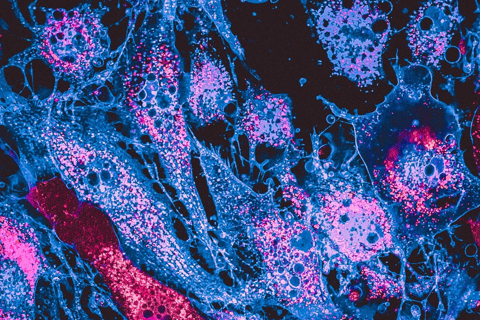 Creato un sistema per il trapianto di mitocondri sani