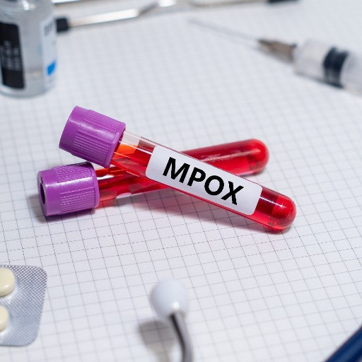 Vaiolo delle scimmie: la nuova variante più contagiosa è ormai predominante in Svizzera