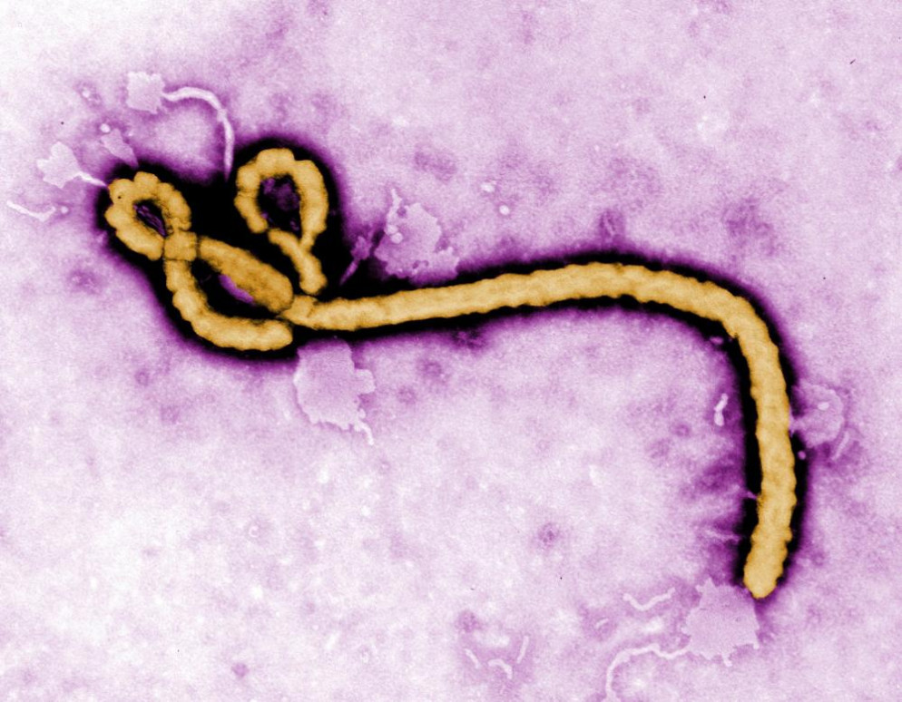 Un'immagine del Bundibugyo ebolavirus. © AP/Frederick Murphy/CDC&nbsp;