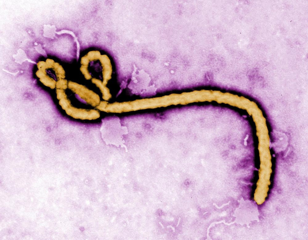 Il virus Bundibugyo. © Frederick Murphy