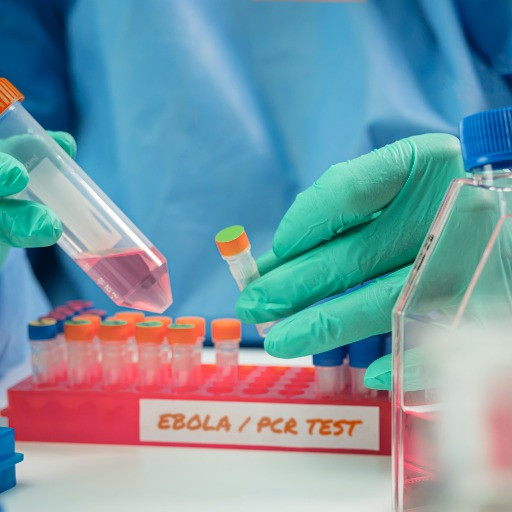 Ebola, approfondimenti sanitari in corso a Milano per due persone con febbre rientrate dall'Uganda