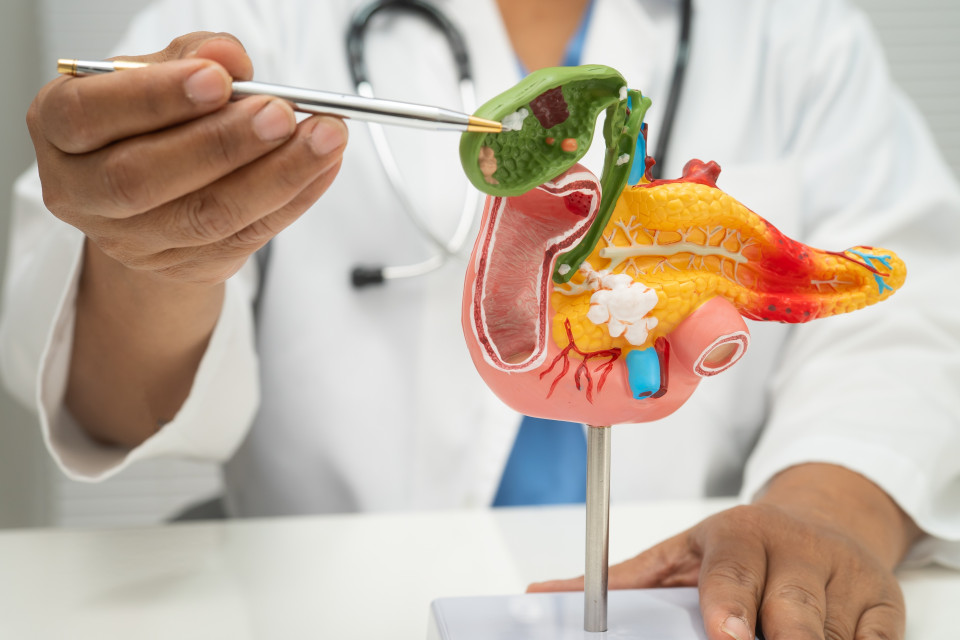 Tumore del pancreas, un nuovo farmaco allunga la sopravvivenza