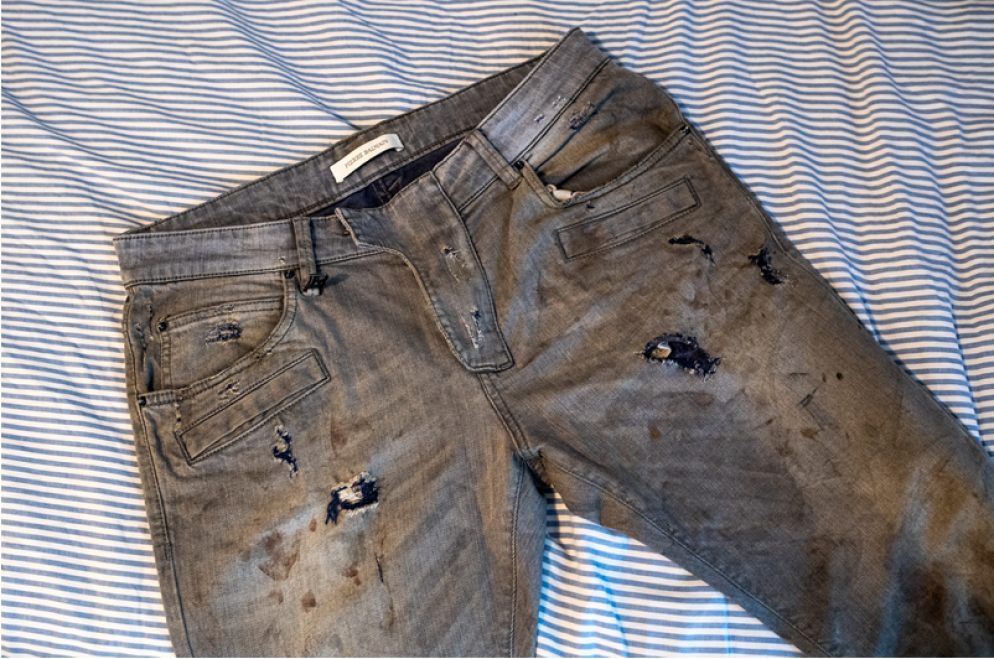 I pantaloni che indossava Filippo la sera di capodanno, con i segni delle fiamme (© CdT/Gabriele Putzu)