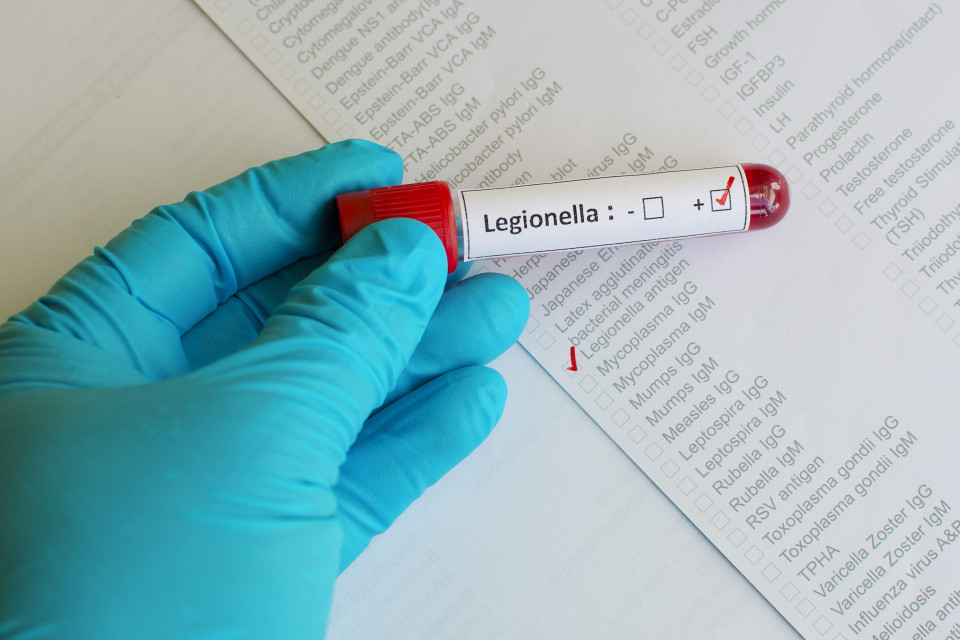 Focolaio di legionellosi, avviato un procedimento penale