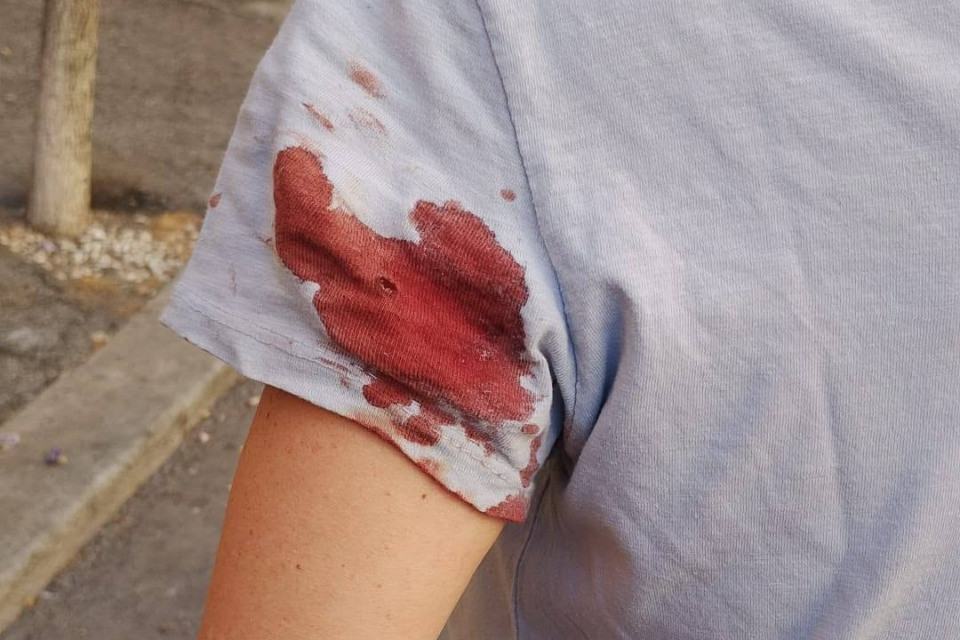 Spari a Roma, la donna colpita a due passi dal Vaticano: «Poteva finire molto peggio»