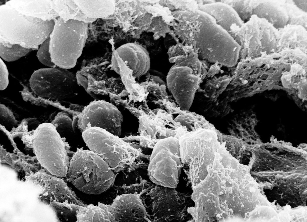 Il bacillo Yersinia pestis visto al microscopio. © Rocky Mountain Laboratories, NIAID, NIH