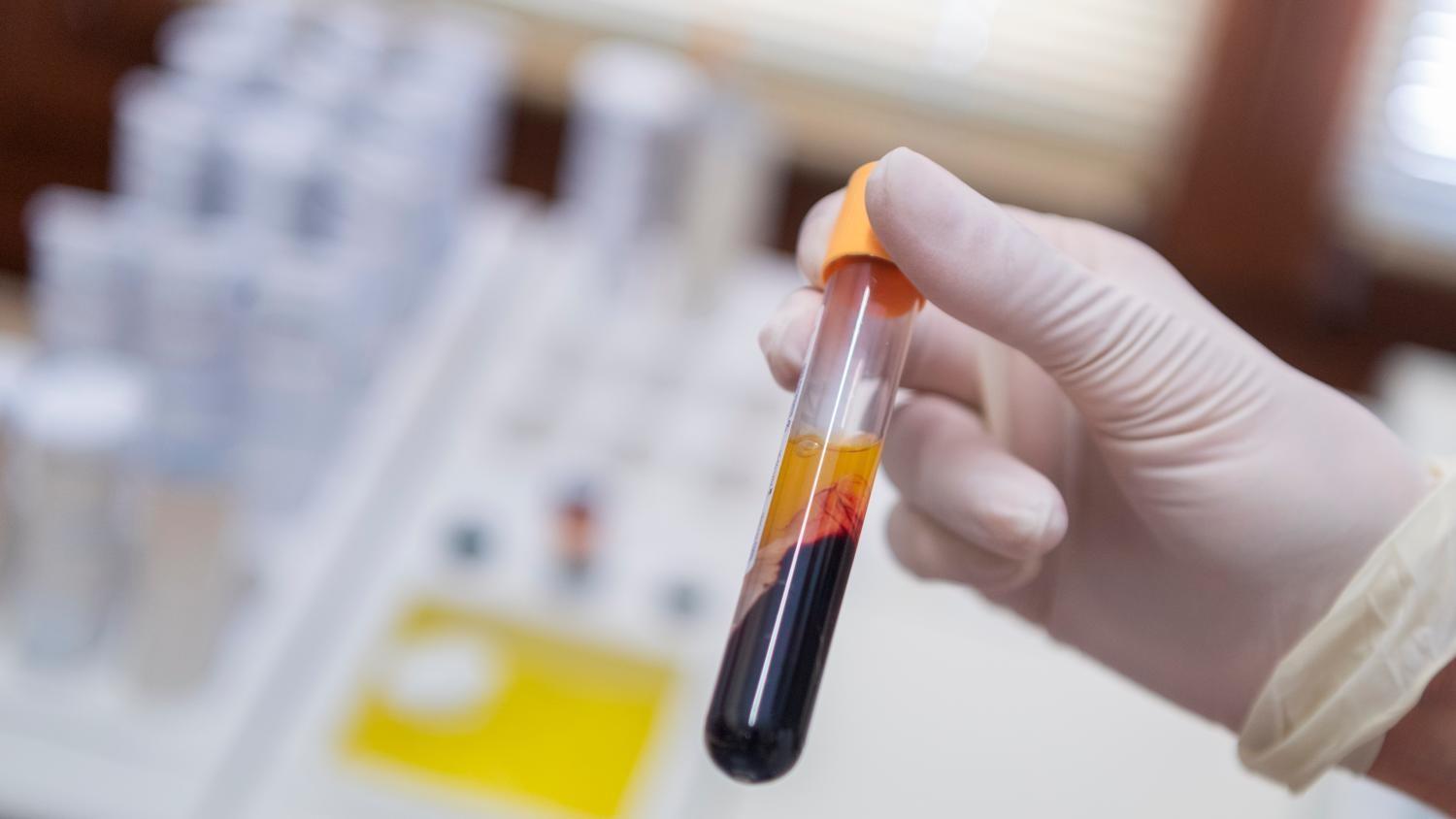 Sciaffusa è rimasto senza medico cantonale